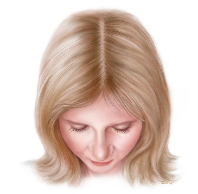 Illustration showing normal female hairline