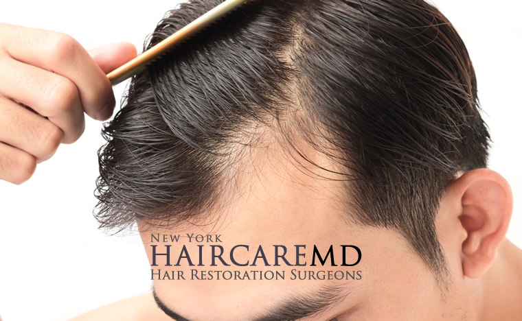 Hair restoration in NYC