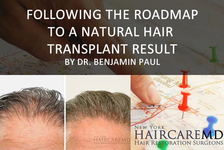 Roadmap to a natural hair transplant result - NYC Hair Restoration experts