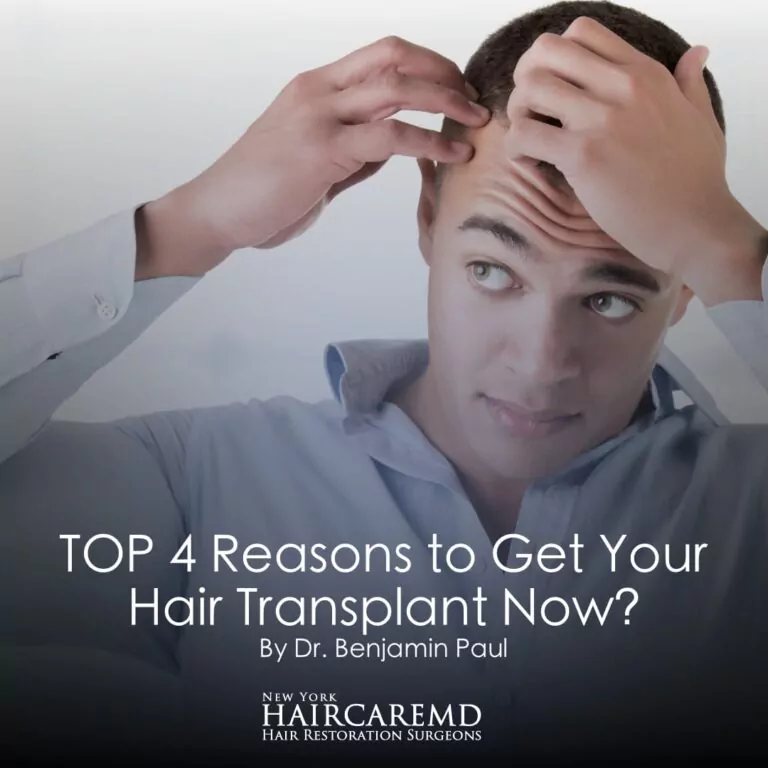 Top 4 reasons to get your hair transplant now